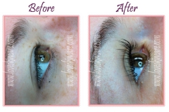 eyelash_extensions_before_after